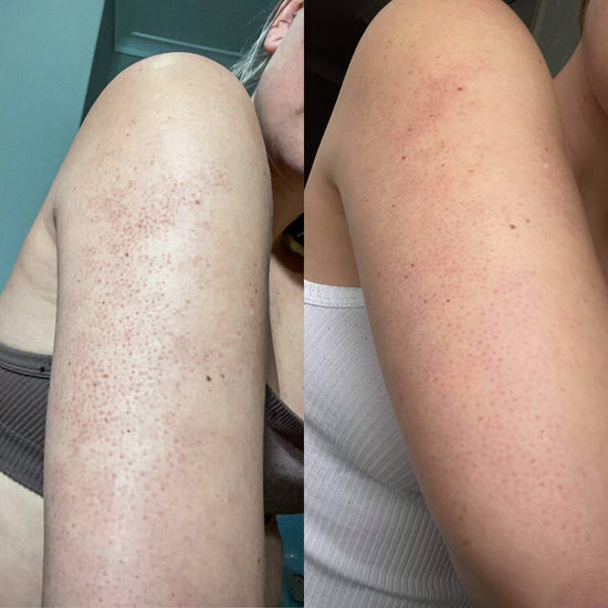 Smooth Skin
